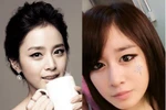 "Chữa" mắt bé thành mắt to long lanh như Kim Tae Hee, Ji Yeon 