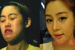 Công nghệ thẩm mỹ biến "vịt" thành "hot girl" ở xứ Kim chi