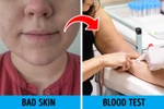 9 điều khiến cơ thể bạn già đi nhanh chóng