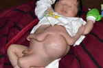 Em bé mới sinh ở Tây Ninh có bốn cánh tay