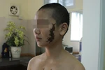 Người xăm rết lên mặt cô gái: "Có tiền thì tôi làm"