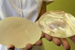10 nghìn phụ nữ TPHCM nâng ngực trong một năm