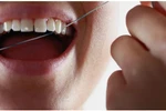 Dùng chỉ nha khoa có giúp giảm sâu răng?