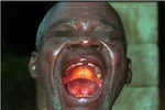 Cảnh báo sốc: Mỗi tuần có thể xuất hiện thêm 10.000 ca nhiễm Ebola