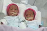  Hình ảnh đáng yêu của các bé sơ sinh trong ca sinh 5 đầu tiên tại VN