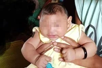 Việt Nam xác nhận em bé đầu tiên mắc chứng đầu nhỏ nghi do vi rút Zika