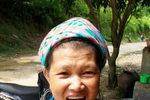 Có một nơi ở VN, phụ nữ đến 30 tuổi là... rụng hết răng