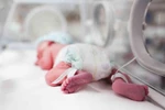Sinh 'ép' trẻ 1,7kg, cả 2 mẹ con tử vong