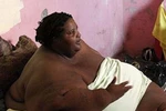 Hành trình chống bệnh 'cuồng ăn' của người phụ nữ 314 kg