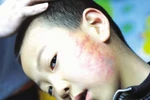 Trò rủa thầy "ngu ngốc"; Cô giáo tát học sinh 30 cái, chảy máu tai