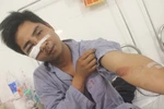 "Không có căn cứ việc 141 Hà Nội đánh gãy xương gò má dân"