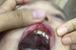 Giáo viên Ecokids đánh học sinh, nhà trường đuổi việc cô giáo, thế là xong?