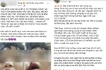 Phụ huynh Tiểu học Tân Triều tố giáo viên động tay, môi học sinh sưng vếu