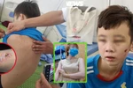 Trẻ em bị lạm dụng sức lao động, đánh đập bởi sự vô cảm của người lớn