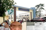 Học sinh bị dị ứng mẩn ngứa, phụ huynh TH Hải Bối cần Hiệu trưởng trả lời rõ