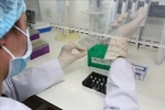 Cho phép đặt hàng cung cấp dịch vụ xét nghiệm SARS-CoV-2