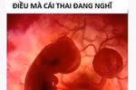 Sững người: Suy nghĩ của cô gái trẻ phá thai và cái thai bị phá