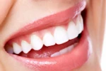 Bột nghệ có giúp làm trắng răng không?
