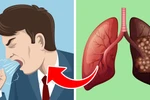 5 dấu hiệu cảnh báo phổi của bạn đang gặp vấn đề