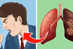 5 dấu hiệu cảnh báo phổi của bạn đang gặp vấn đề