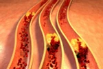 Những biện pháp tự nhiên để giảm mức cholesterol