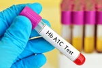 Xét nghiệm A1C để kiểm soát bệnh tiểu đường
