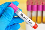 Xét nghiệm A1C để kiểm soát bệnh tiểu đường