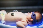 Làm thế nào để nhận biết bệnh vàng da ở trẻ sơ sinh?
