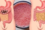 7 cách an toàn giúp làm sạch ruột già và giữ gìn tuổi trẻ của bạn