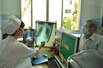 Thành lập Ủy ban Quốc gia về chấm dứt bệnh Lao