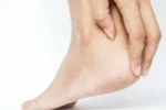 Những cách điều trị nứt gót chân tại nhà hiệu quả