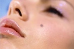 Hai kiểu làm đẹp hủy hoại nhan sắc