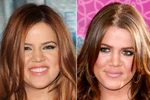 Em gái Kardashian 'sửa mũi' hết 45 USD