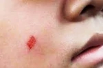Ai sẽ bảo vệ giáo viên khi bị bạo hành?