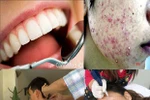 Rùng mình dịch vụ làm đẹp, chăm sóc sức khỏe "chết người"