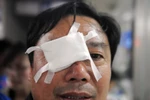 Pháo hoa bắn vào dân, gần trăm người nhập viện