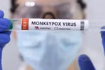 Bộ Y tế hướng dẫn cách phòng ngừa lây nhiễm bệnh đậu mùa khỉ tại cơ sở y tế