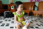 Điểm báo sáng ngày 29/6: Bảo mẫu phạt bé 3 tuổi đứng nắng bỏng chân
