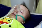 Đối phó với bệnh sởi: Thêm hơn 80 tỷ đồng và 12 máy thở