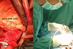 Những công nghệ chữa bệnh hiện đại, đặc biệt ở bệnh viện Bạch Mai
