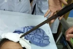 Bộ Giáo dục yêu cầu xử lý vụ học sinh ném dao vào bạn