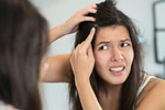 Tai hại ít biết từ thói quen nhổ tóc bạc