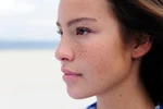 Điều trị nám da tận gốc với kem nám da Tây Thi