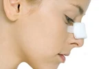 Bị viêm xoang, phẫu thuật nâng mũi có ảnh hưởng gì không?