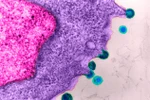 Hy vọng mới cho bệnh nhân HIV: Điều trị bằng kháng thể