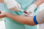 6 xét nghiệm máu phải làm trước 30 tuổi