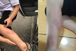Giáo viên đánh học sinh trong giờ kiểm tra, hiệu trưởng bị kiểm điểm trách nhiệm