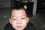 Cô giáo bị nghi đánh vào mắt học sinh đã được bố trí dạy trở lại
