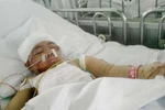 Những cái chết thương tâm của trẻ tại trường mầm non