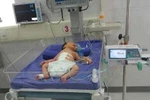Phẫu thuật cứu sống bé mới sinh lộ nội tạng ra ngoài